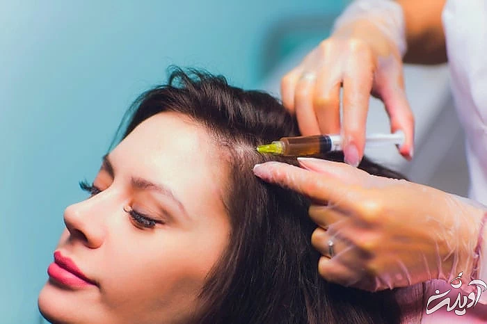 تزریق به مو 